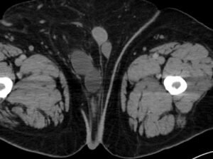 Creative Commons images