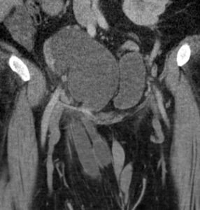 Creative Commons images