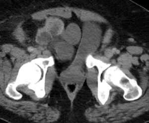 Creative Commons images