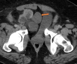 Creative Commons images