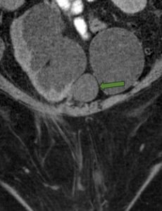 Creative Commons images