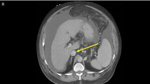 Creative Commons images