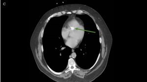 Creative Commons images