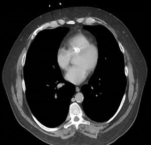 Creative Commons images