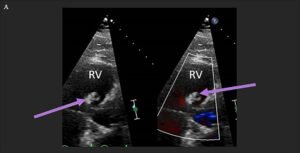 Creative Commons images