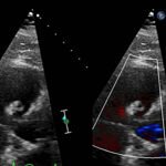 Unravelling the Mystery of a Continuous Coil: A Case Report 5 Creative Commons images
