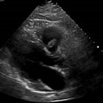 Unravelling the Mystery of a Continuous Coil: A Case Report 6 Creative Commons images