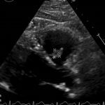 Unravelling the Mystery of a Continuous Coil: A Case Report 16 Creative Commons images