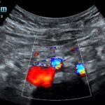 Creative Commons images