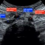 Creative Commons images