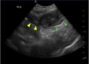 Creative Commons images