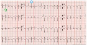 Creative Commons images