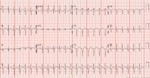 Creative Commons images