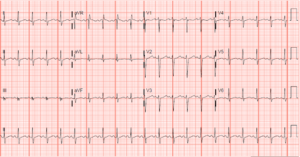 Creative Commons images