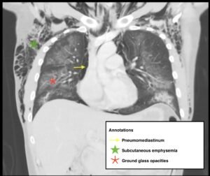 Creative Commons images