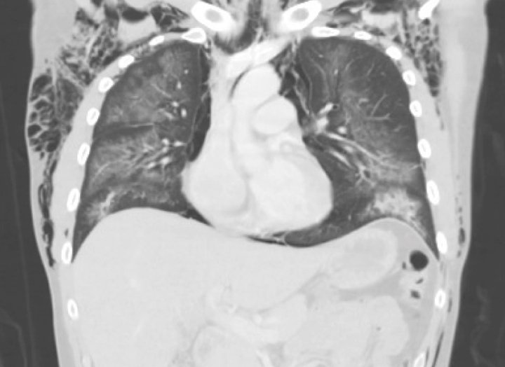 Creative Commons images