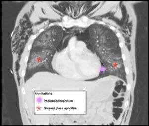 Creative Commons images