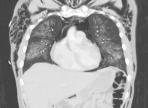 Creative Commons images