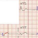 Creative Commons images