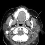 Creative Commons images