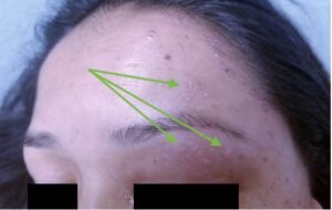 Creative Commons images