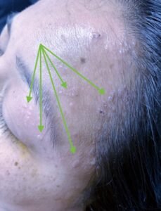 Creative Commons images