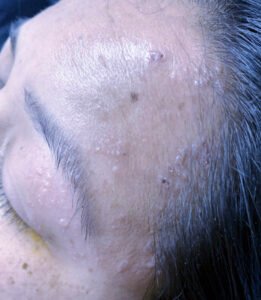 Creative Commons images