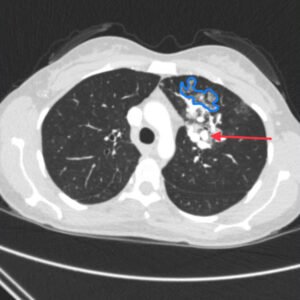 Creative Commons images