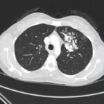 Creative Commons images