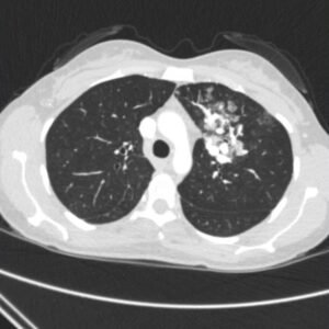 Creative Commons images