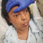 Mucormycosis. Photograph 2. JETem 2023